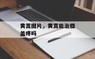 黄蒿图片，黄蒿能治膝盖疼吗
